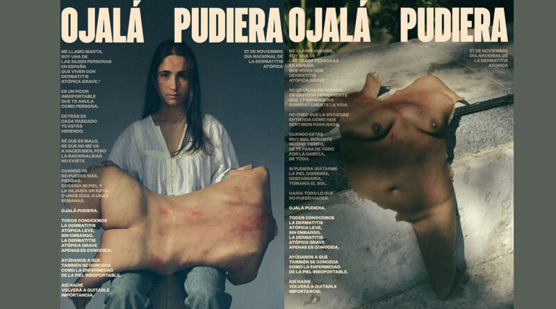 Las instalaciones se exhibirán durante el 27 de noviembre en tres ubicaciones de Madrid: el Museo del Prado, el Parque del Retiro y la Puerta de Toledo